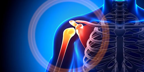 Tips for Faster Recovery After Shoulder Arthroscopy