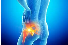Top Warning Signs of Hip Joint Problems